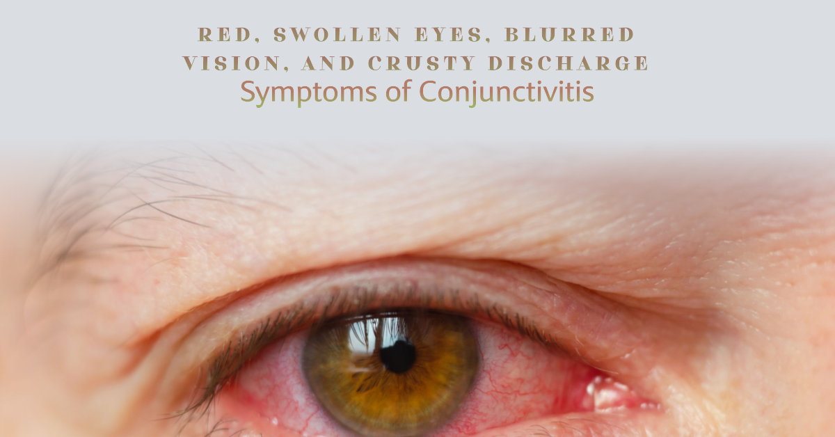 what-are-the-symptoms-of-conjunctivitis