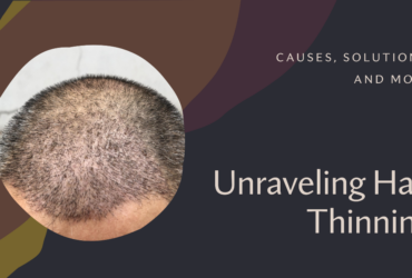 hair-thinning-causes-and-solutions