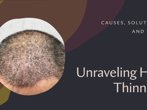 hair-thinning-causes-and-solutions